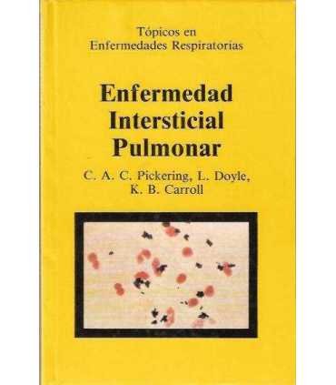 Enfermedad Intersticial Pulmonar