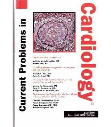 Cardiology Hipertensión pulmonar. Cardiopatías. Los péptidos. Síndrome de Brugada