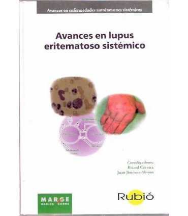 Avances en lupus eritematoso sistémico