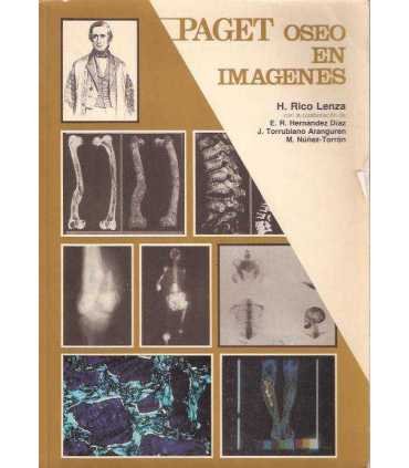 Paget oseo en imagenes