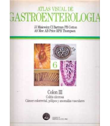 Atlas visual de Gastroenterología, 6. Colon III