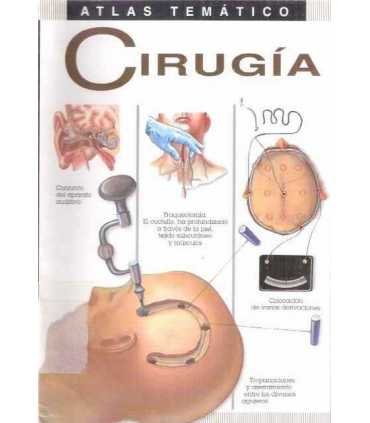 Atlas temático: Cirugía
