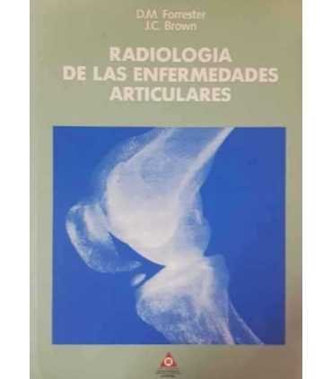 Radiología de las enfermedades articulares
