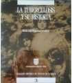 La tuberculosis y su historia
