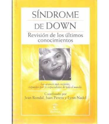 Síndrome de Down: revisión de los últimos conocimi