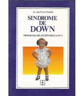 Síndrome de Down