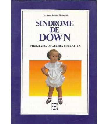 Síndrome de Down